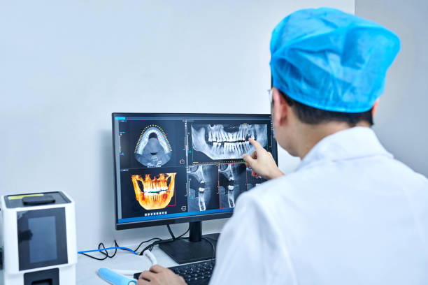 Best Emergency Tooth Extraction  in French Mp, CA